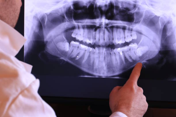 Best Walk-In Emergency Dental Services in Nelsonville, OH