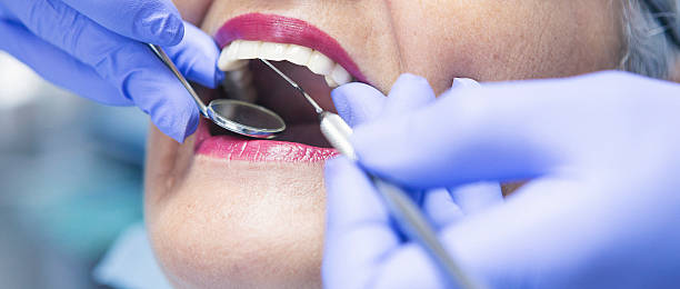 Best Dental Abscess Treatment in Nelsonville, OH