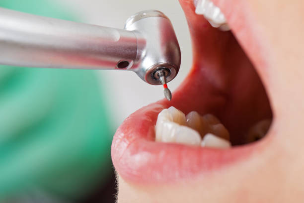Best Emergency Dental Care for Sports Injuries in Nelsonville, OH